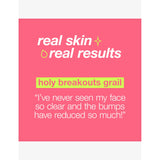 Dermalogica Breakout Clearing Foaming Wash 295ml, UK version