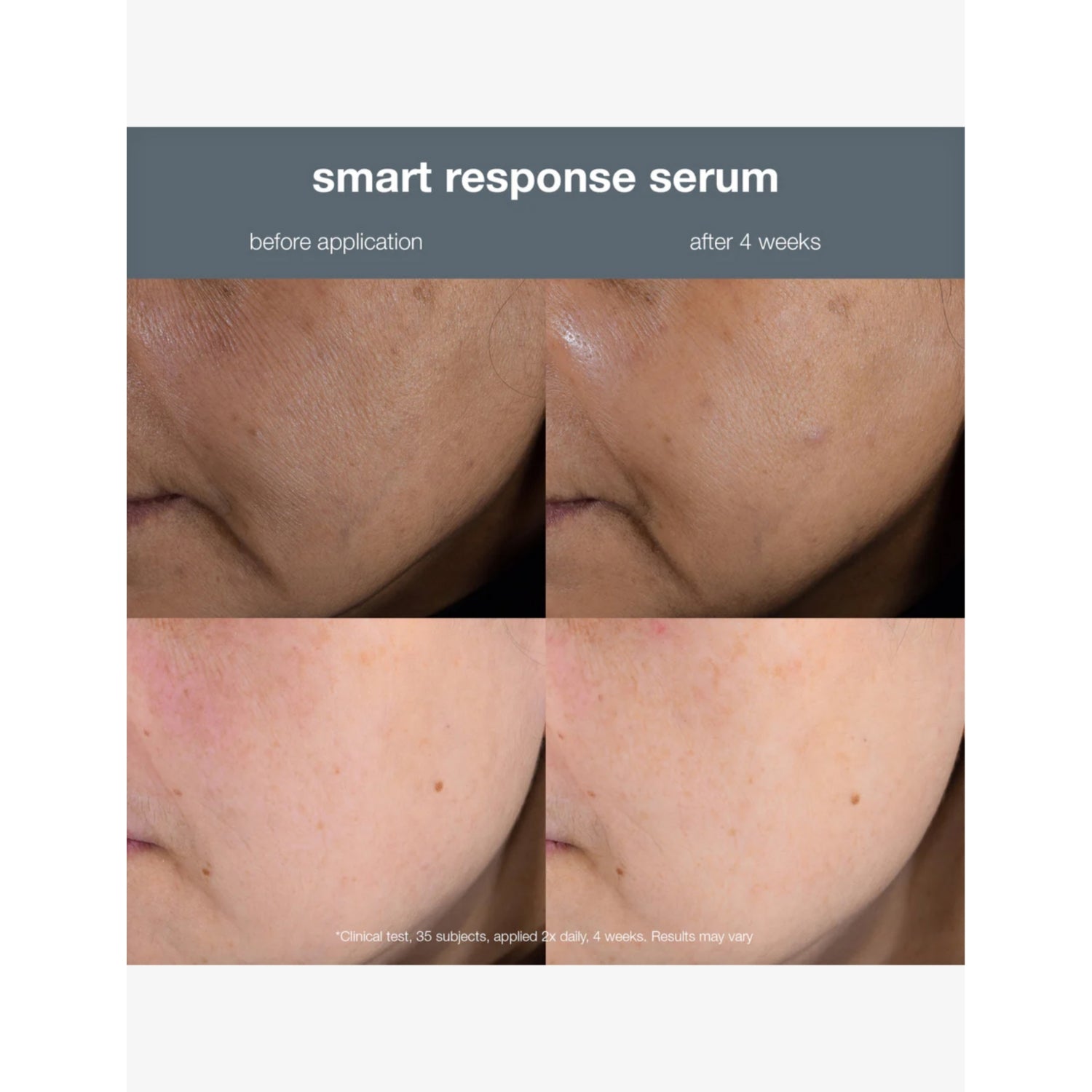 Dermalogica Smart Response face serum 30ml, UK version