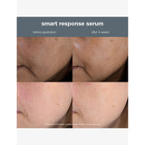 Dermalogica Smart Response face serum 30ml, UK version