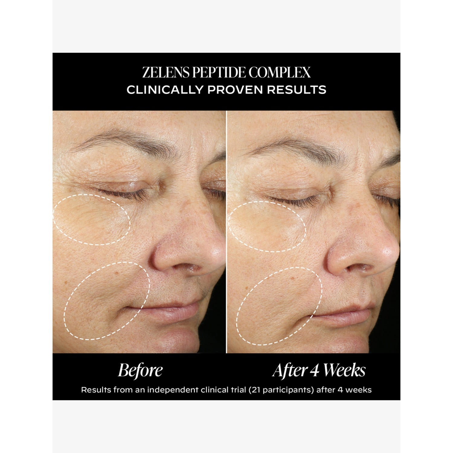 Zelens peptide complex restructuring cream 50ml, imported from the UK