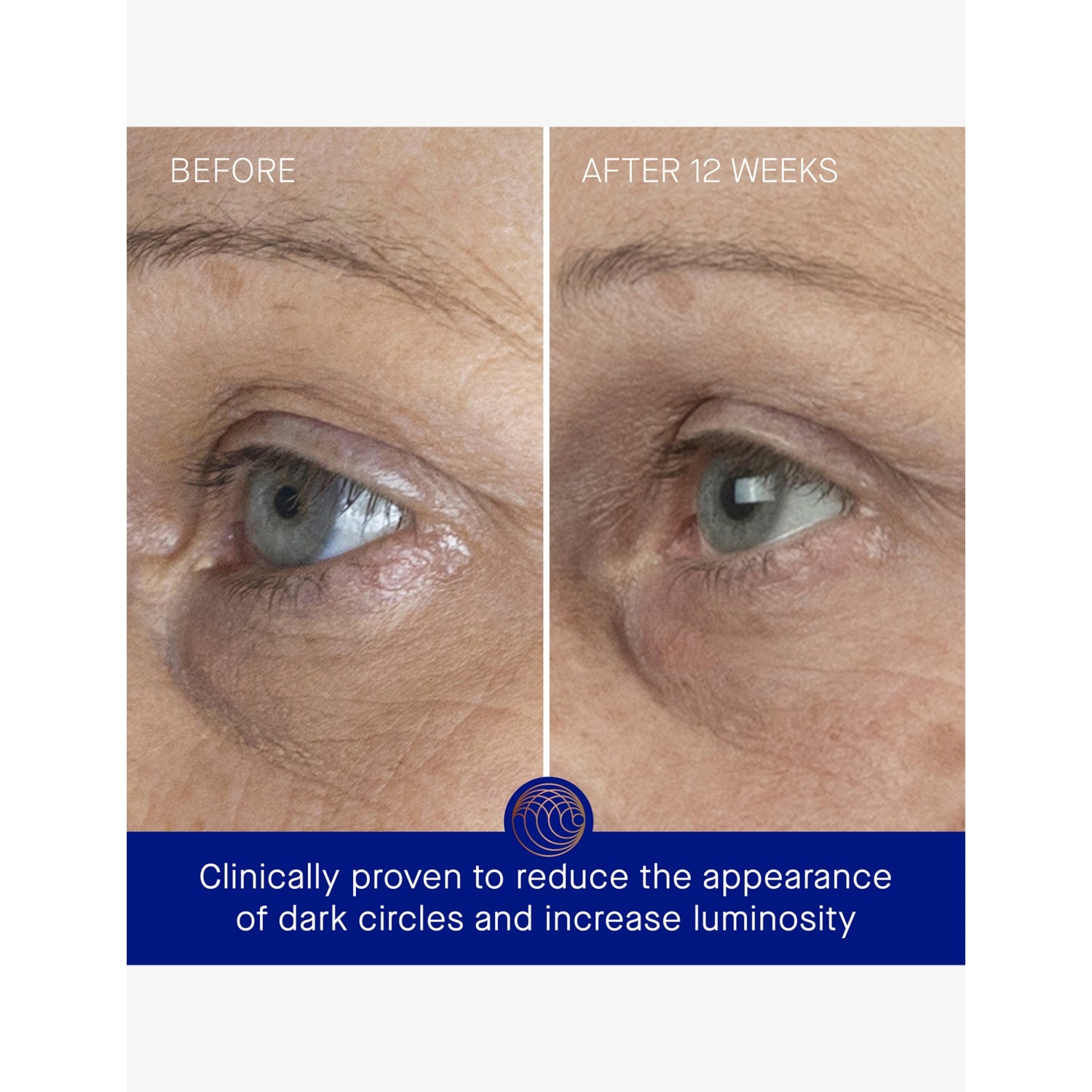 Augustinus Bader The Eye Cream 15ml - British product