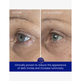 Augustinus Bader The Eye Cream refill 15ml, UK version