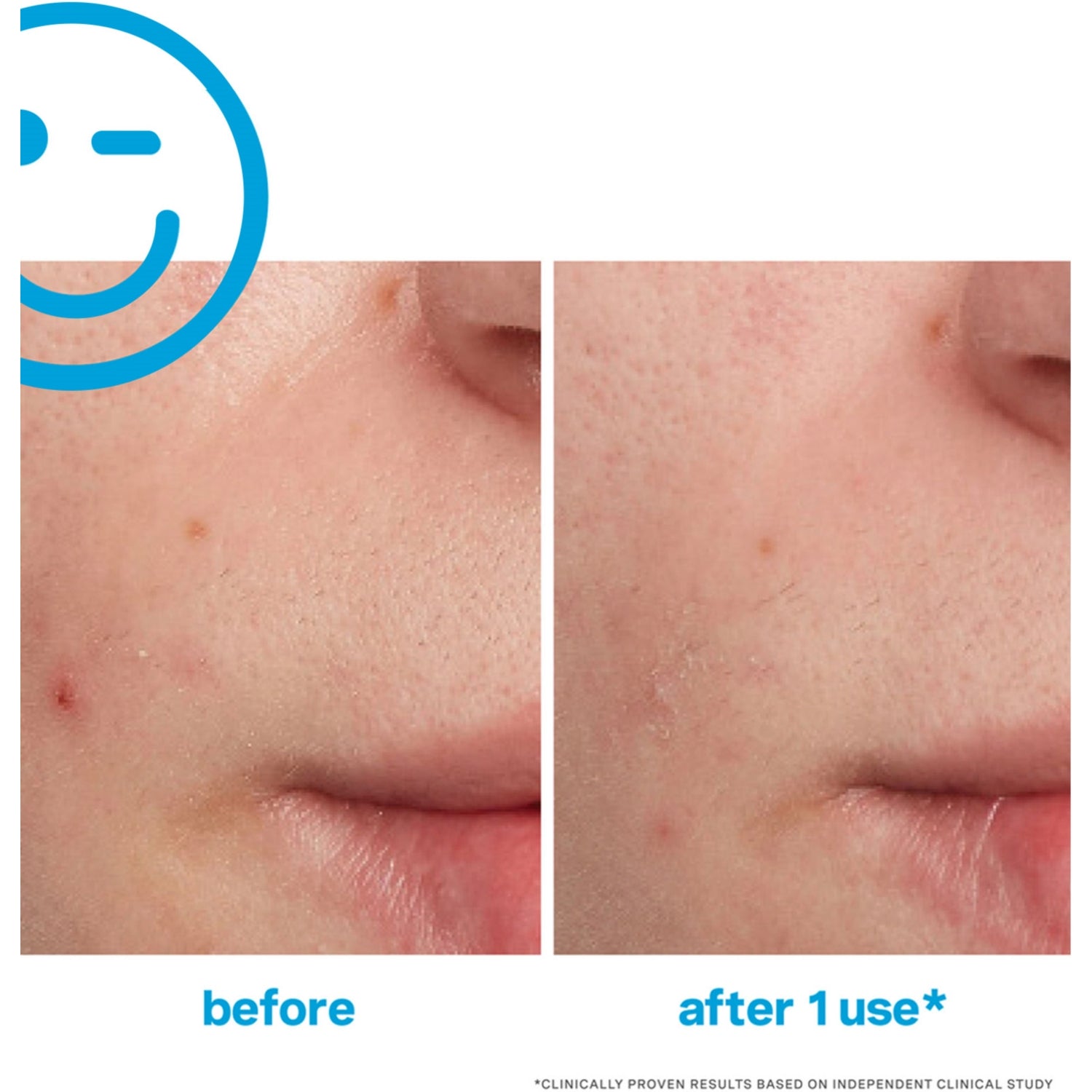 Kate Somerville EradiKate blemish treatment 30ml (British brand)