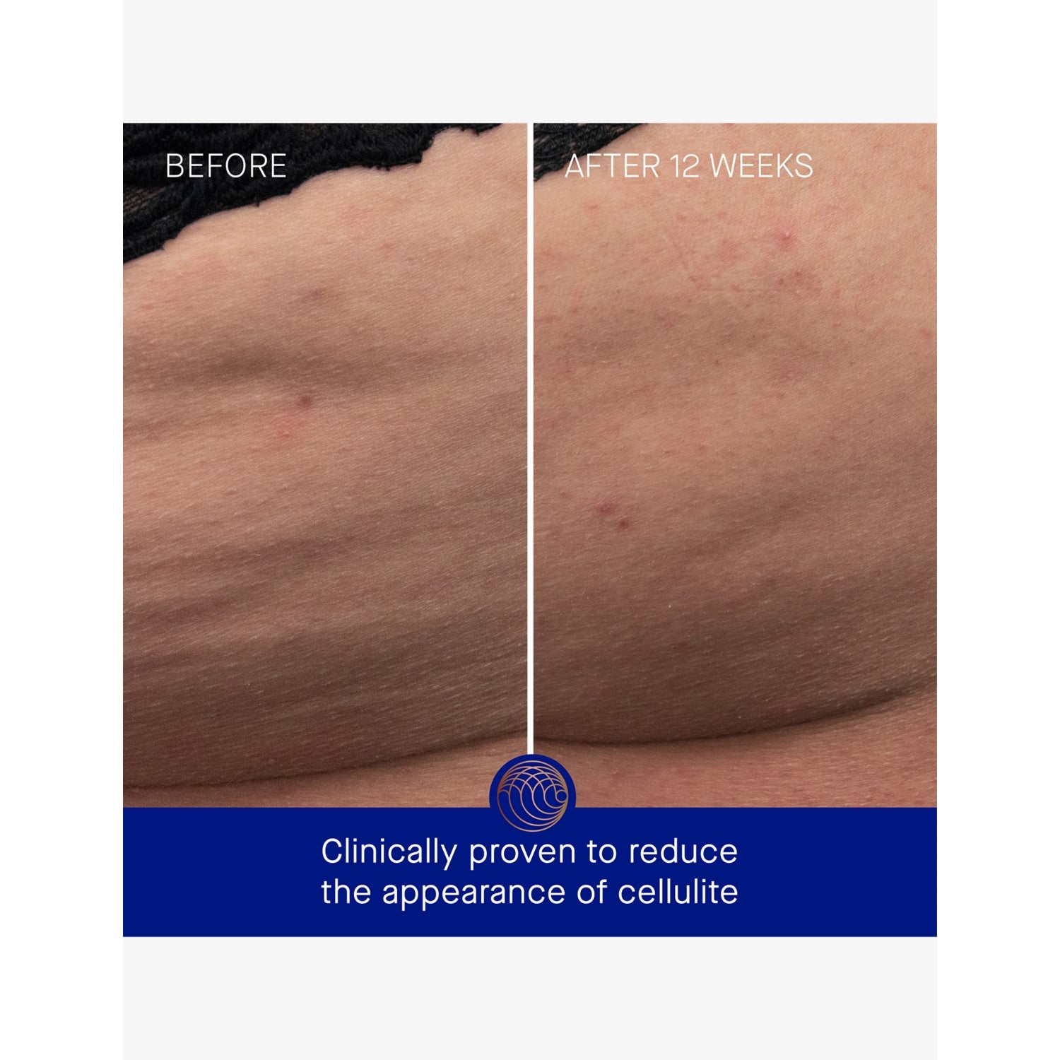 Augustinus Bader body cream 100ml, imported from the UK