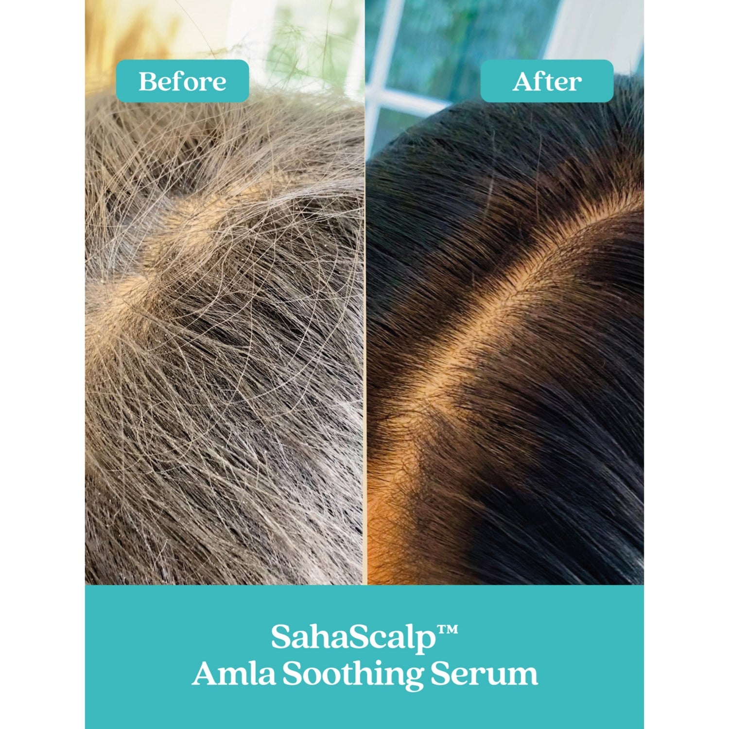 Fable & Mane SahaScalp Amla soothing scalp serum 55ml, UK version