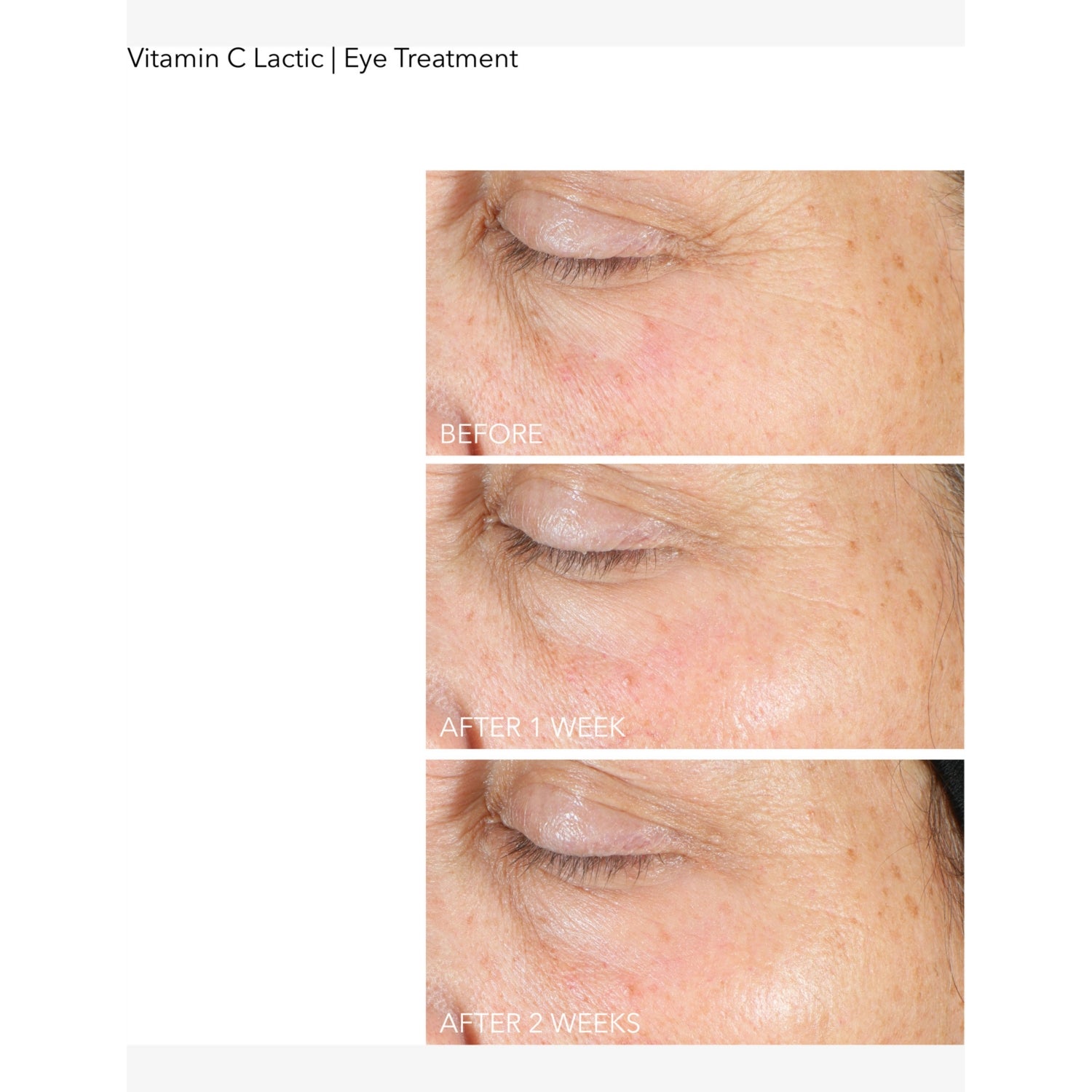 Dr Dennis Gross Vitamin C Lactic eye treatment 15ml (British brand)