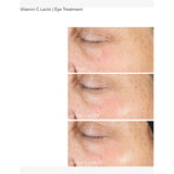 Dr Dennis Gross Vitamin C Lactic eye treatment 15ml (British brand)