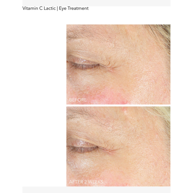 Dr Dennis Gross Vitamin C Lactic eye treatment 15ml (British brand)