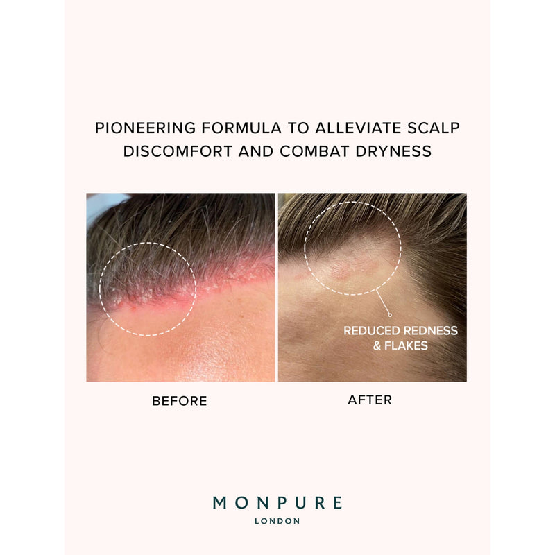 Monpure Hydrate and Soothe scalp serum 50ml (British brand)