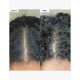 Briogeo Scalp Revival micro-exfoliating shampoo 236ml, imported from the UK