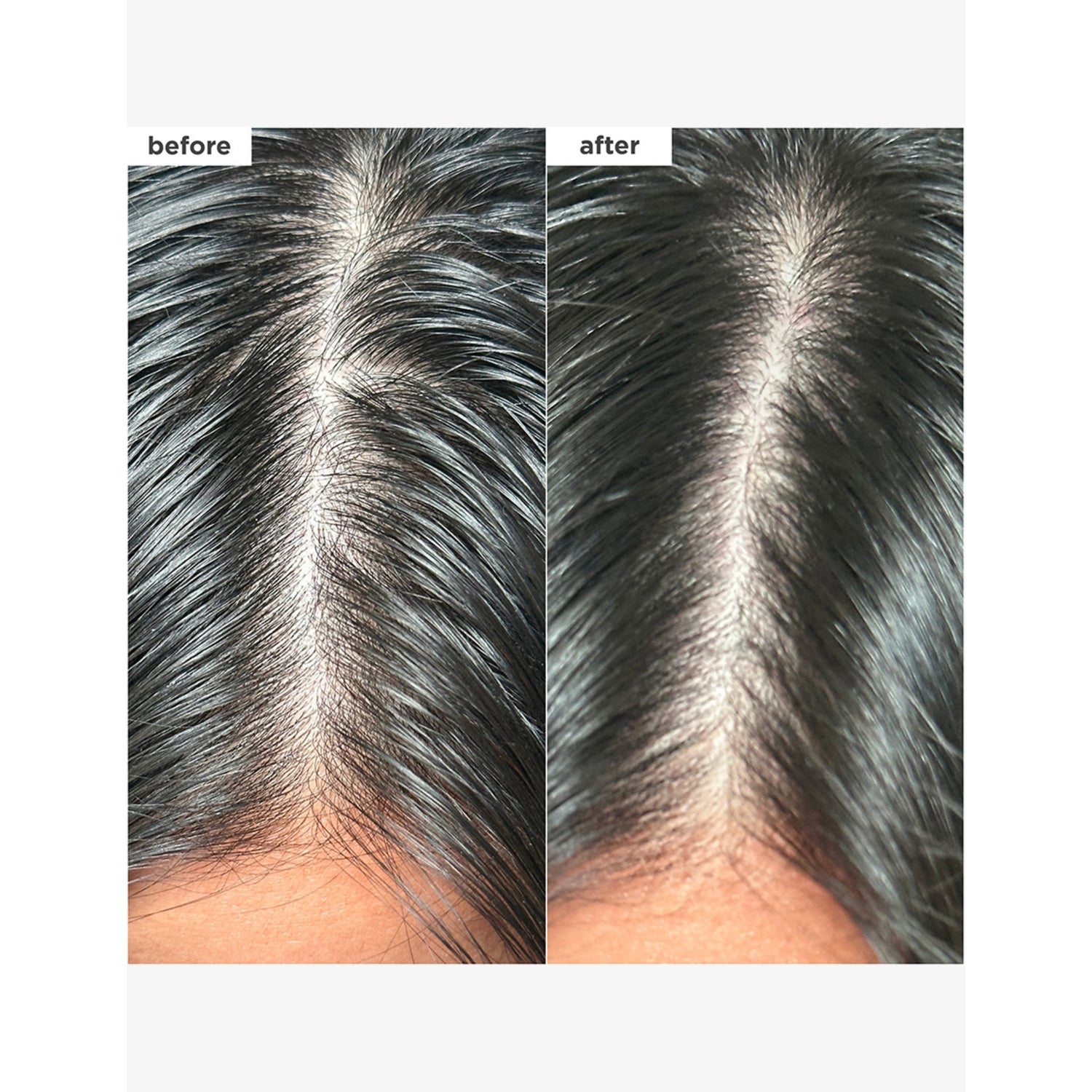 Briogeo Scalp Revival dry shampoo - British product