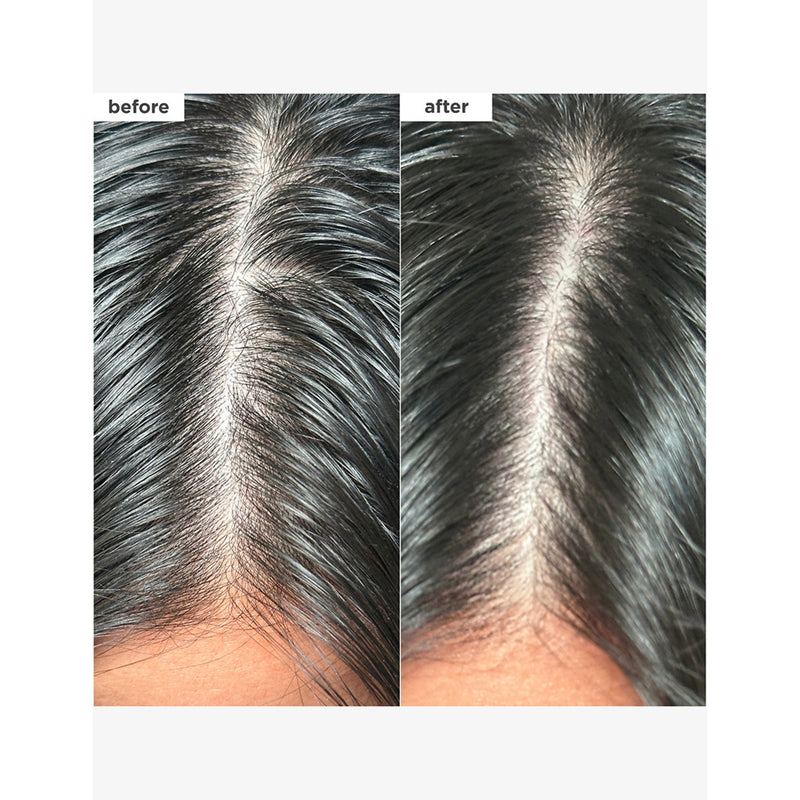 Briogeo Scalp Revival dry shampoo - British product