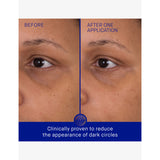 Augustinus Bader eye patches pack of six - British product