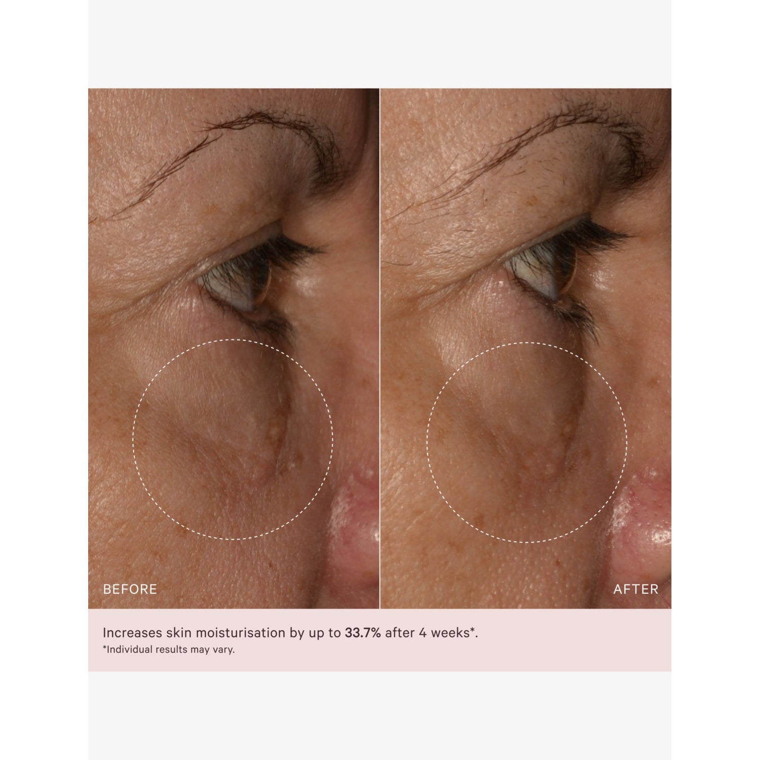 MZ Skin Soothe and Smooth hyaluronic eye complex 14ml - British product