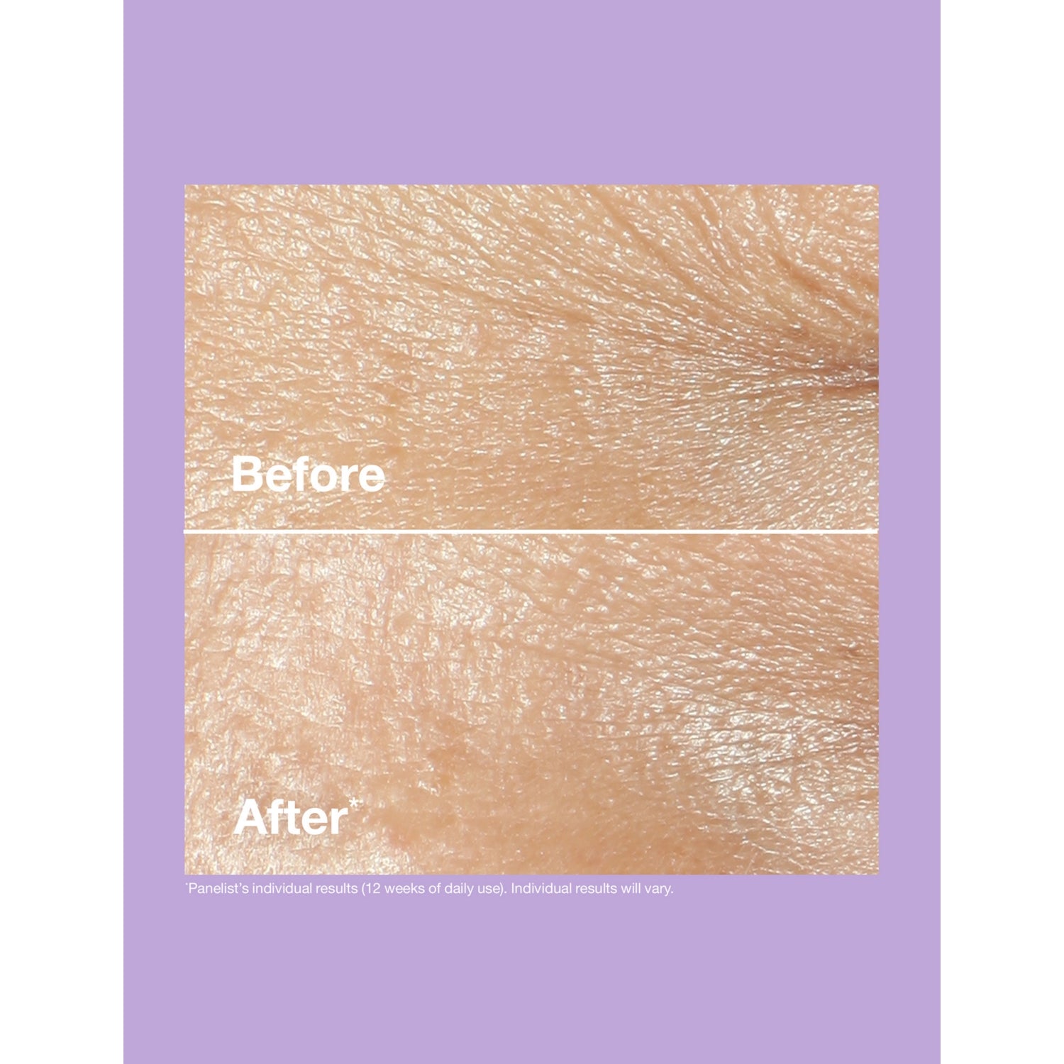 Clinique Smart Clinical Repair wrinkle correcting cream 75ml (British brand)
