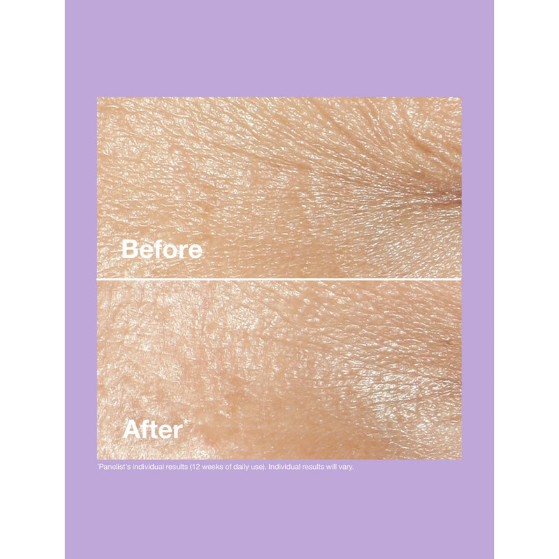 Clinique Smart Clinical Repair wrinkle correcting cream 75ml (British brand)
