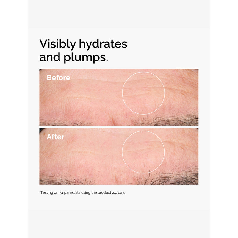 The Ordinary hyaluronic acid 2% + B5 facial serum (British brand)