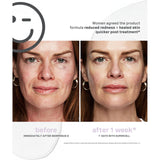 Kate Somerville SuperCell Rejuvenation Serum 30ml (British brand)