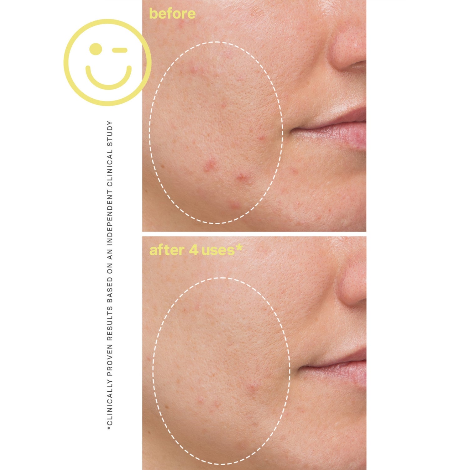 Kate Somerville Mega C-Vit brightening facial 60ml (British brand)