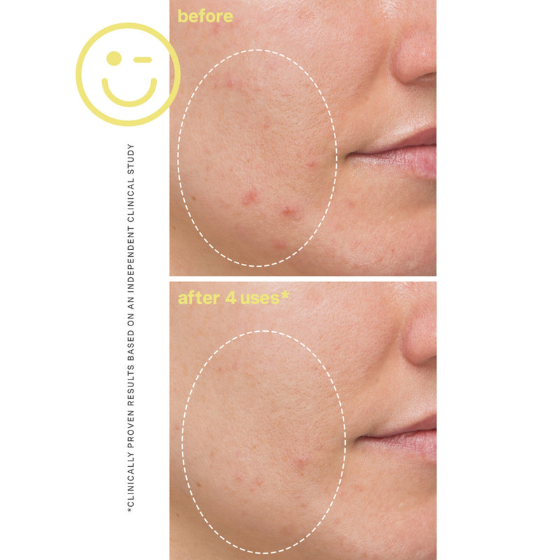 Kate Somerville Mega C-Vit brightening facial 60ml (British brand)