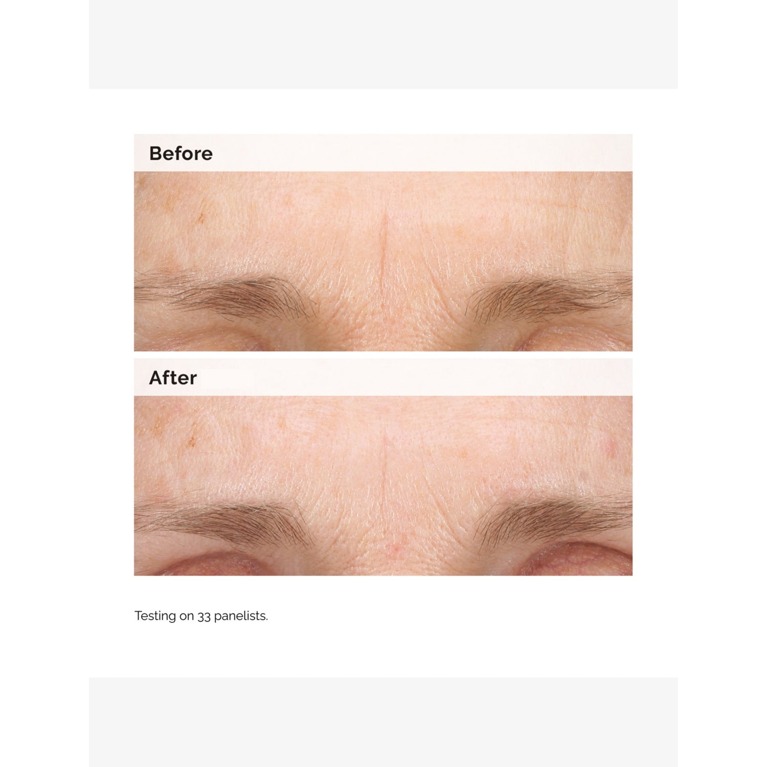 The Ordinary retinal 0.2% emulsion 15ml - British product