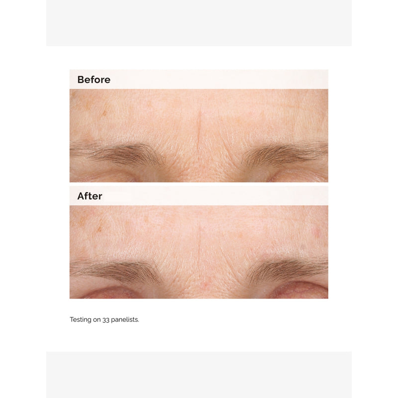 The Ordinary retinal 0.2% emulsion 15ml - British product