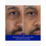 Augustinus Bader The Serum facial serum 15ml, imported from the UK
