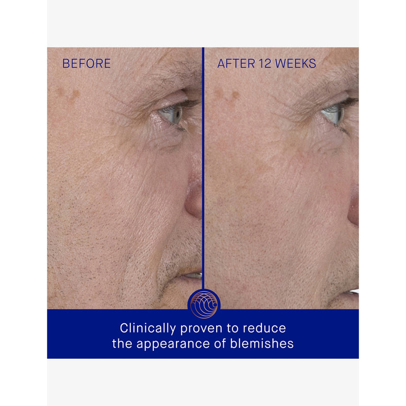 Augustinus Bader The Serum facial serum 15ml, imported from the UK