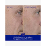 Augustinus Bader The Serum facial serum 15ml, imported from the UK