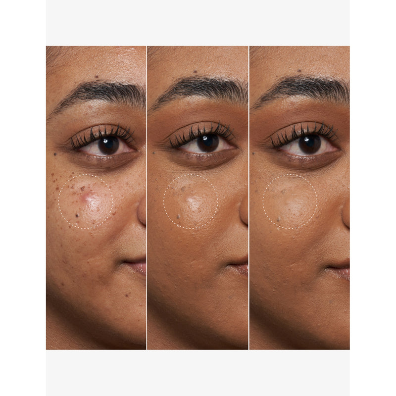 Fenty Beauty BHA spot targeting gel 15ml (British brand)