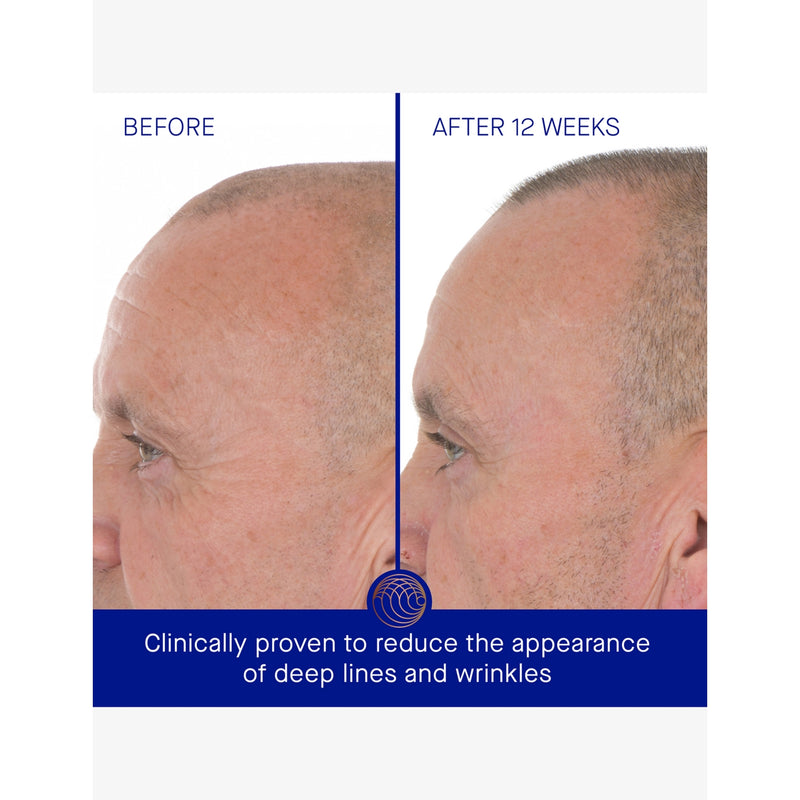 Augustinus Bader retinol serum 50ml (British brand)