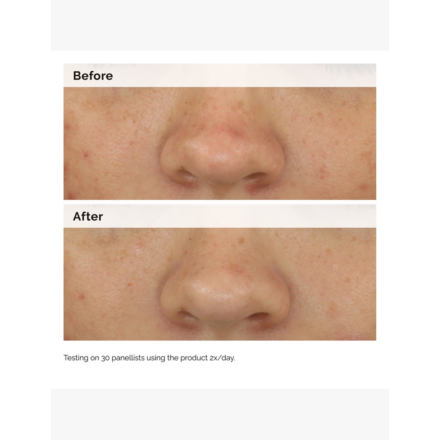 The Ordinary balancing and clarifying serum 30ml, UK version