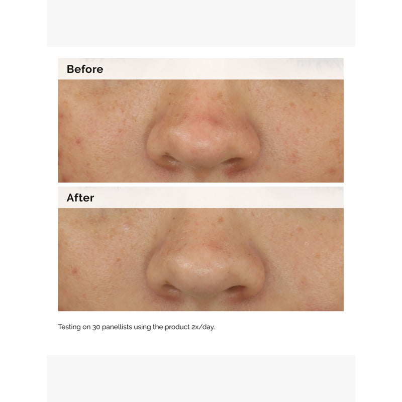 The Ordinary balancing and clarifying serum 30ml, UK version