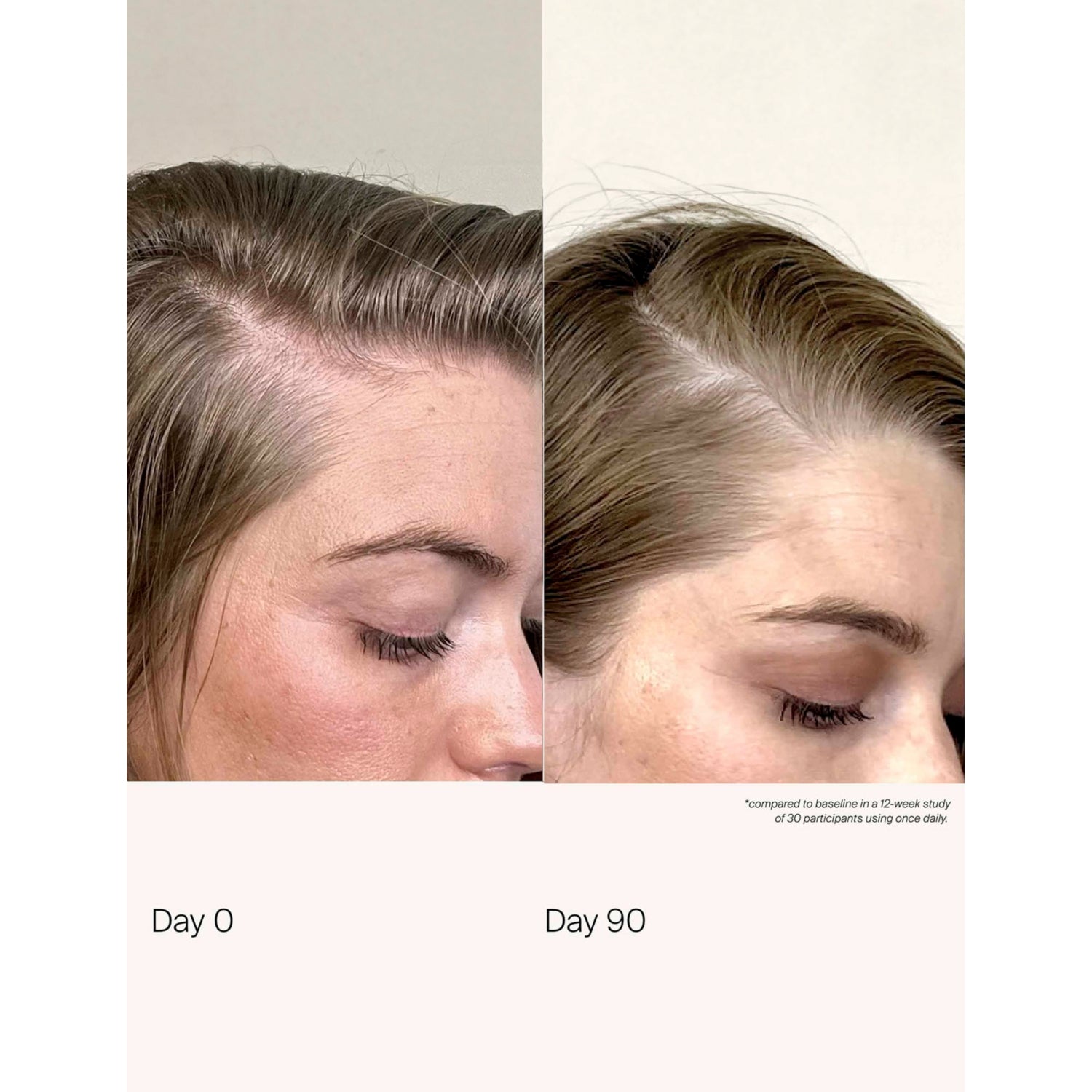 Living Proof scalp care density serum 50ml (British brand)