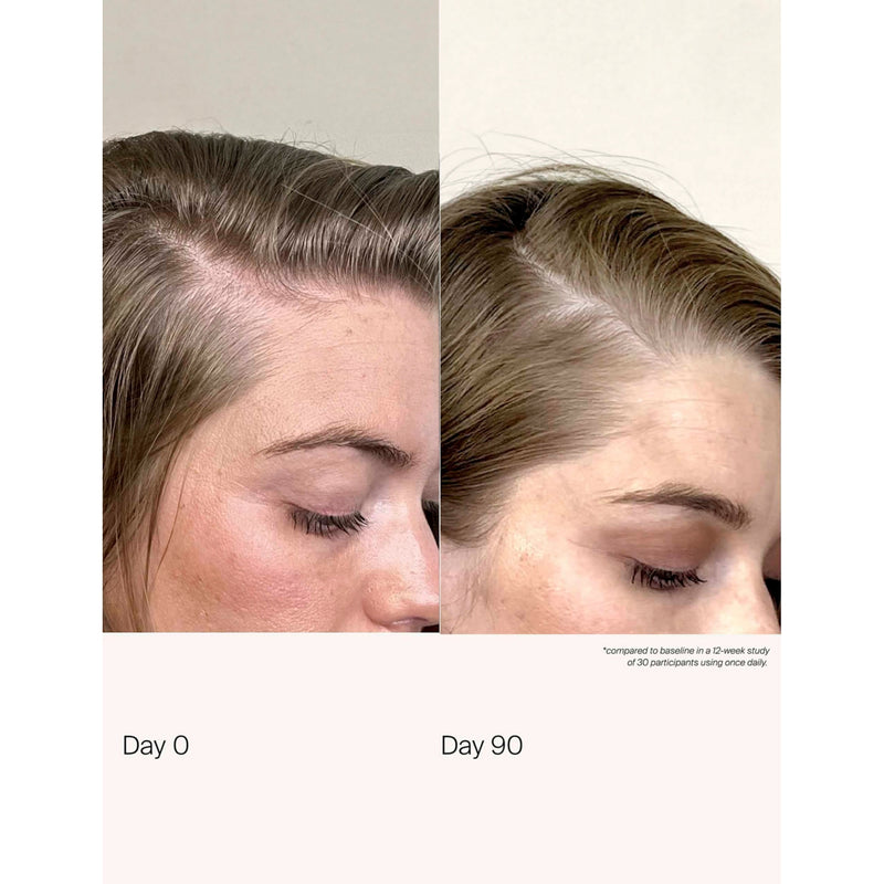Living Proof scalp care density serum 50ml (British brand)