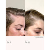 Living Proof scalp care density serum 50ml (British brand)
