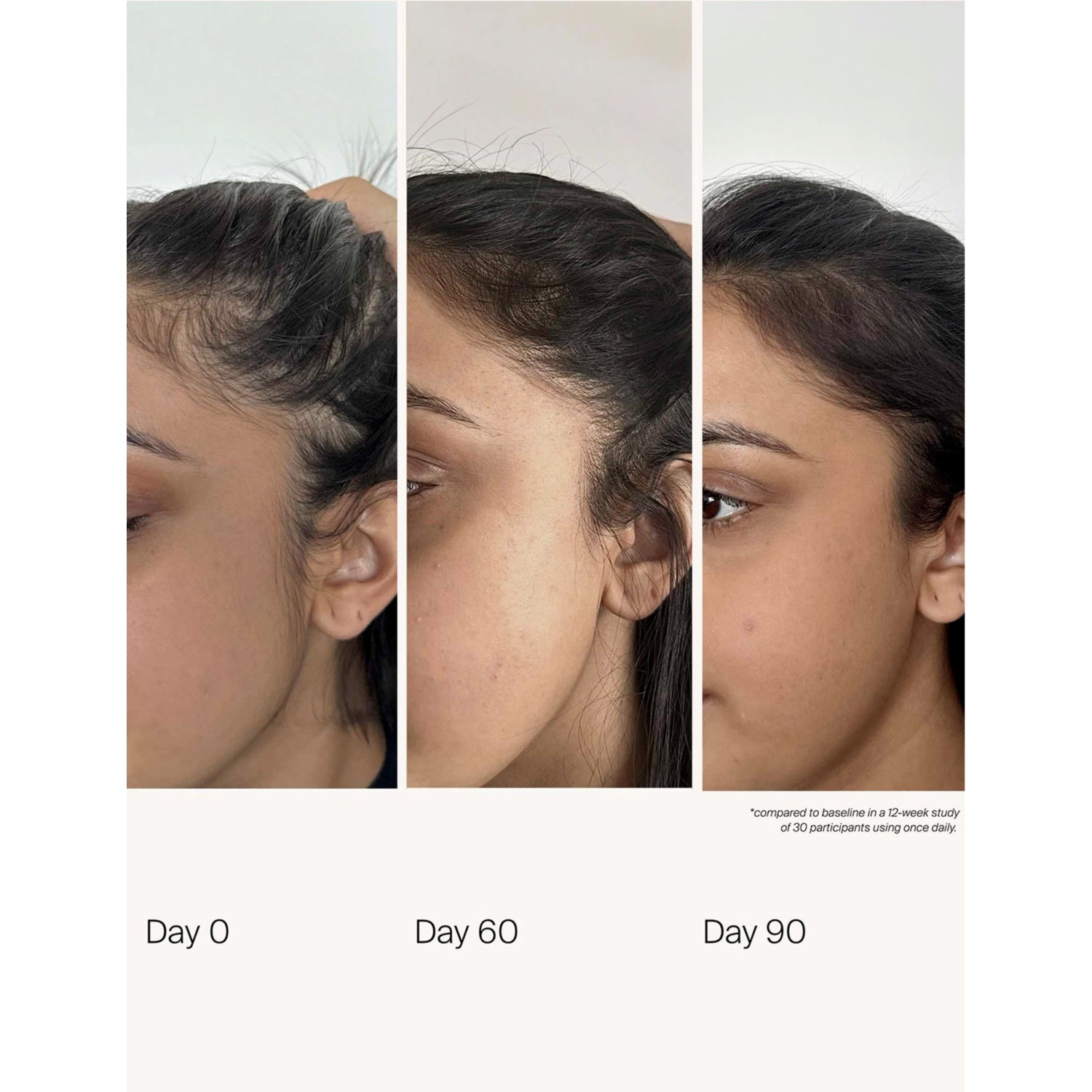 Living Proof scalp care density serum 50ml (British brand)