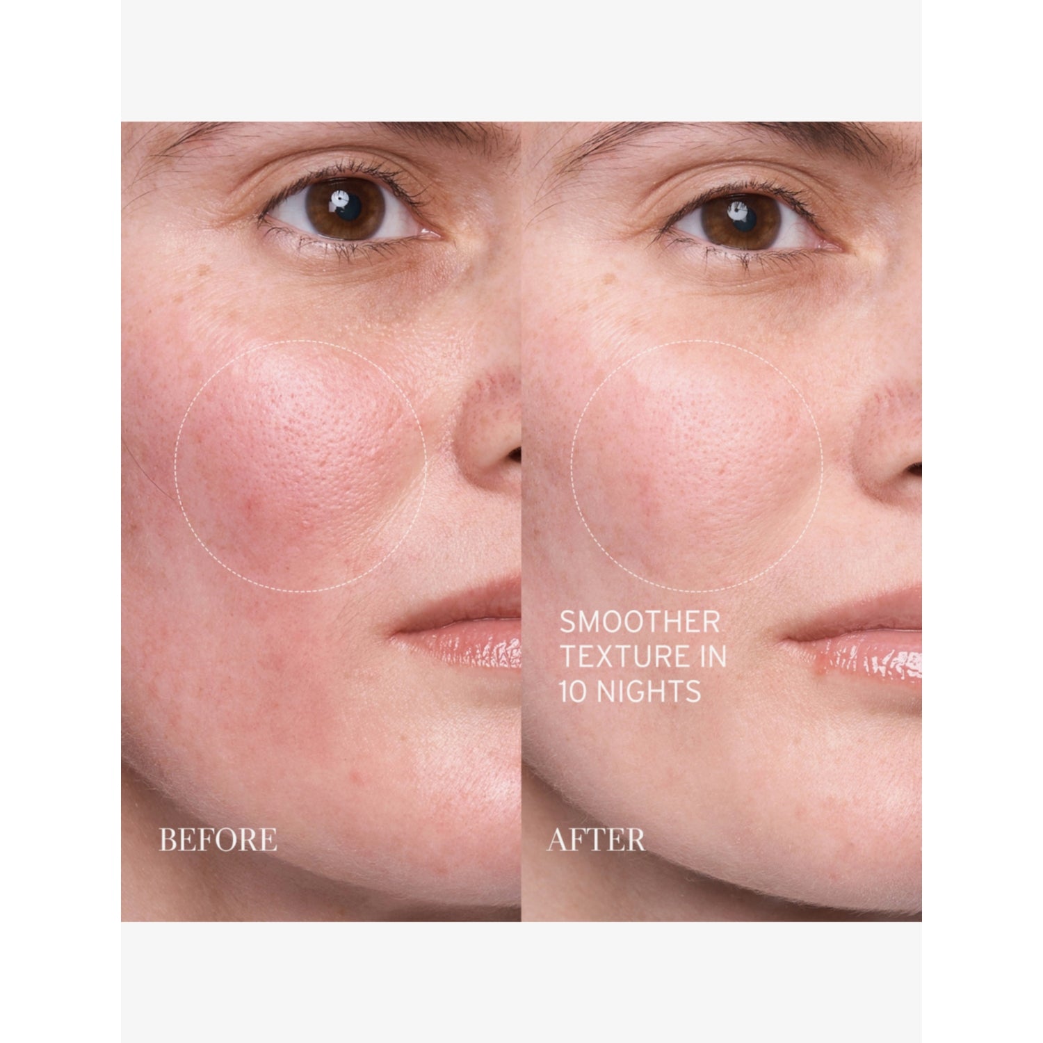Fresh Lotus Youth Preserve resurfacing dream serum 30ml, imported from the UK