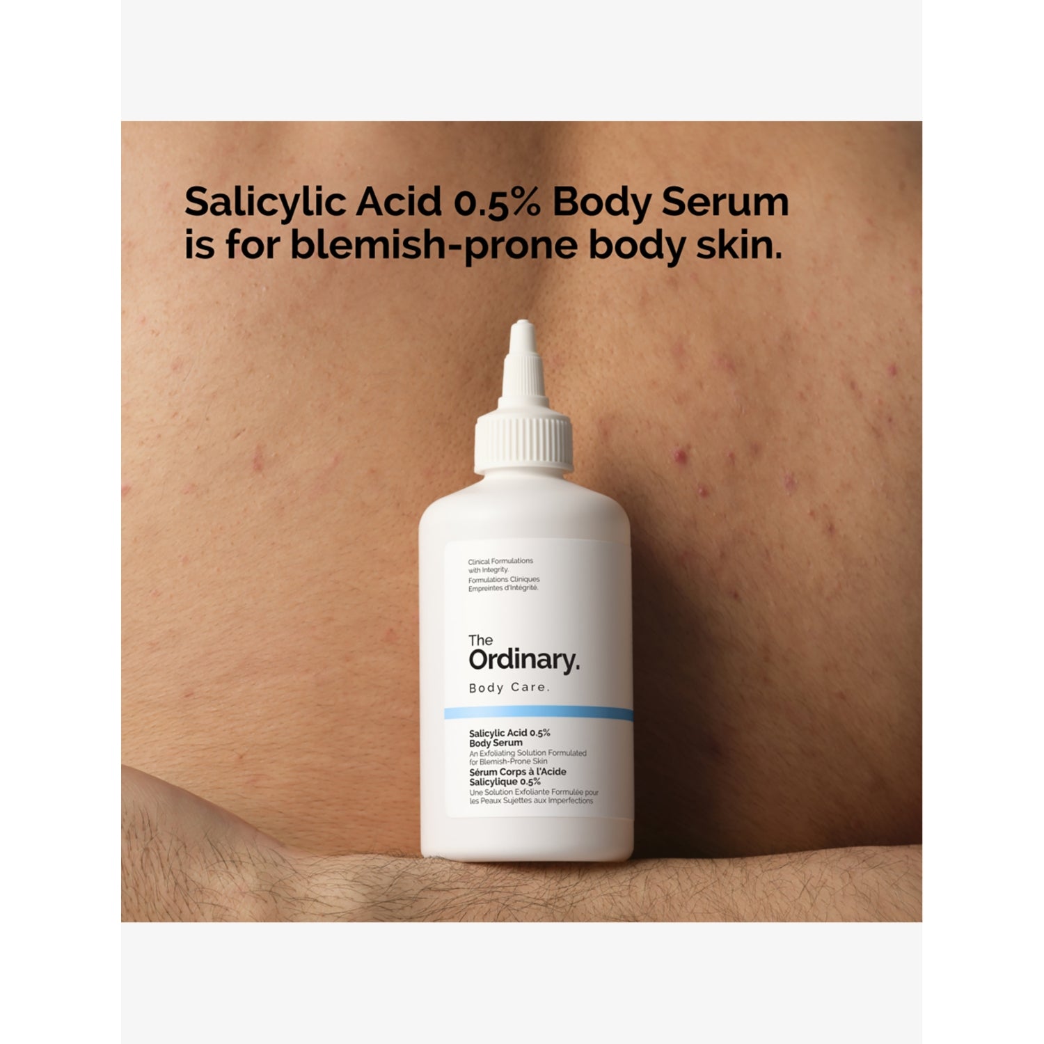 The Ordinary Salicylic Acid 0.5% body serum 240ml, imported from the UK