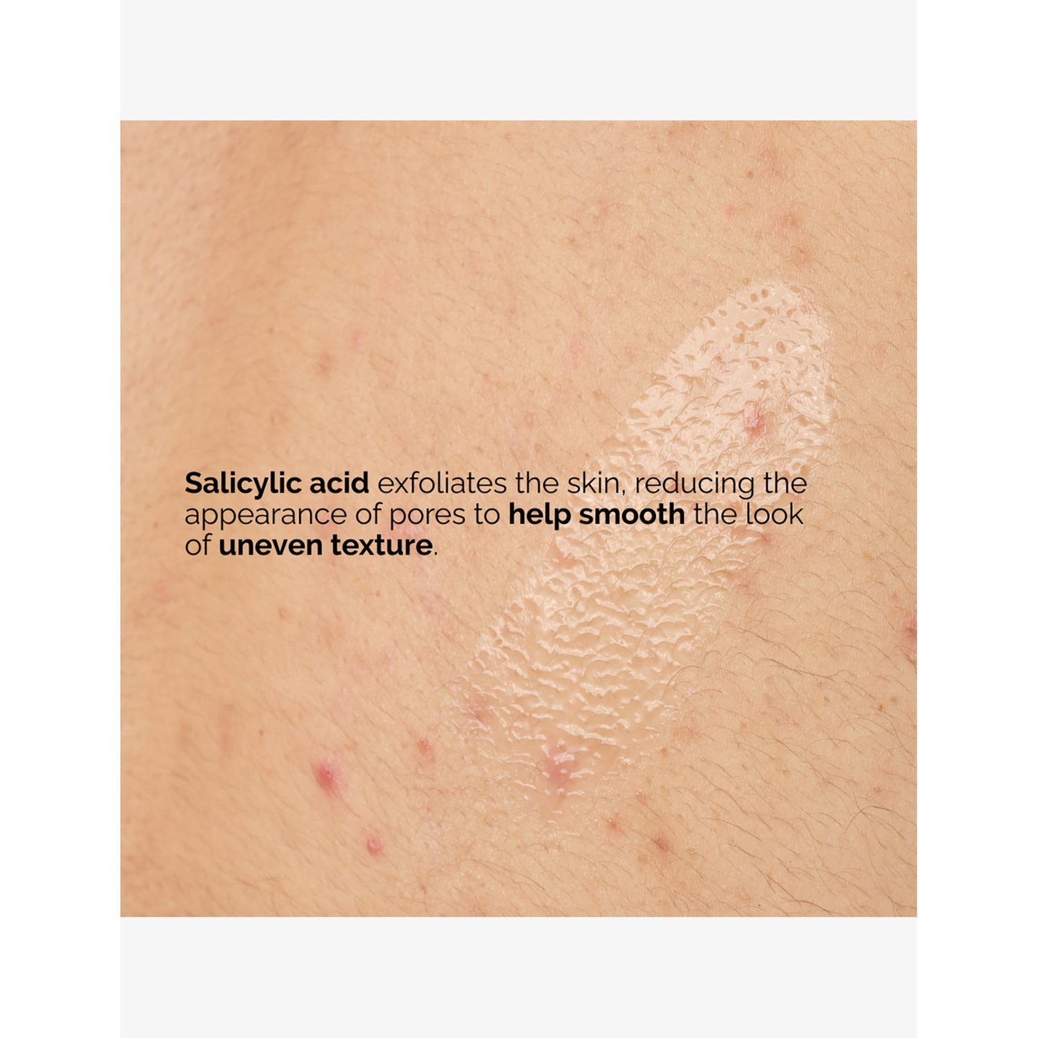 The Ordinary Salicylic Acid 0.5% body serum 240ml, imported from the UK