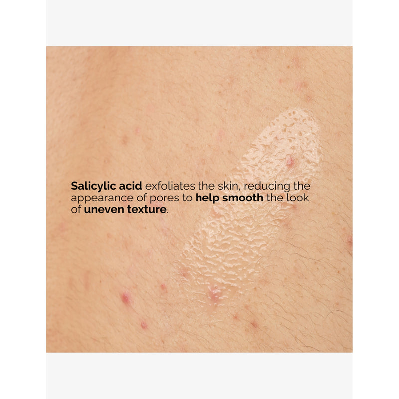 The Ordinary Salicylic Acid 0.5% body serum 240ml, imported from the UK