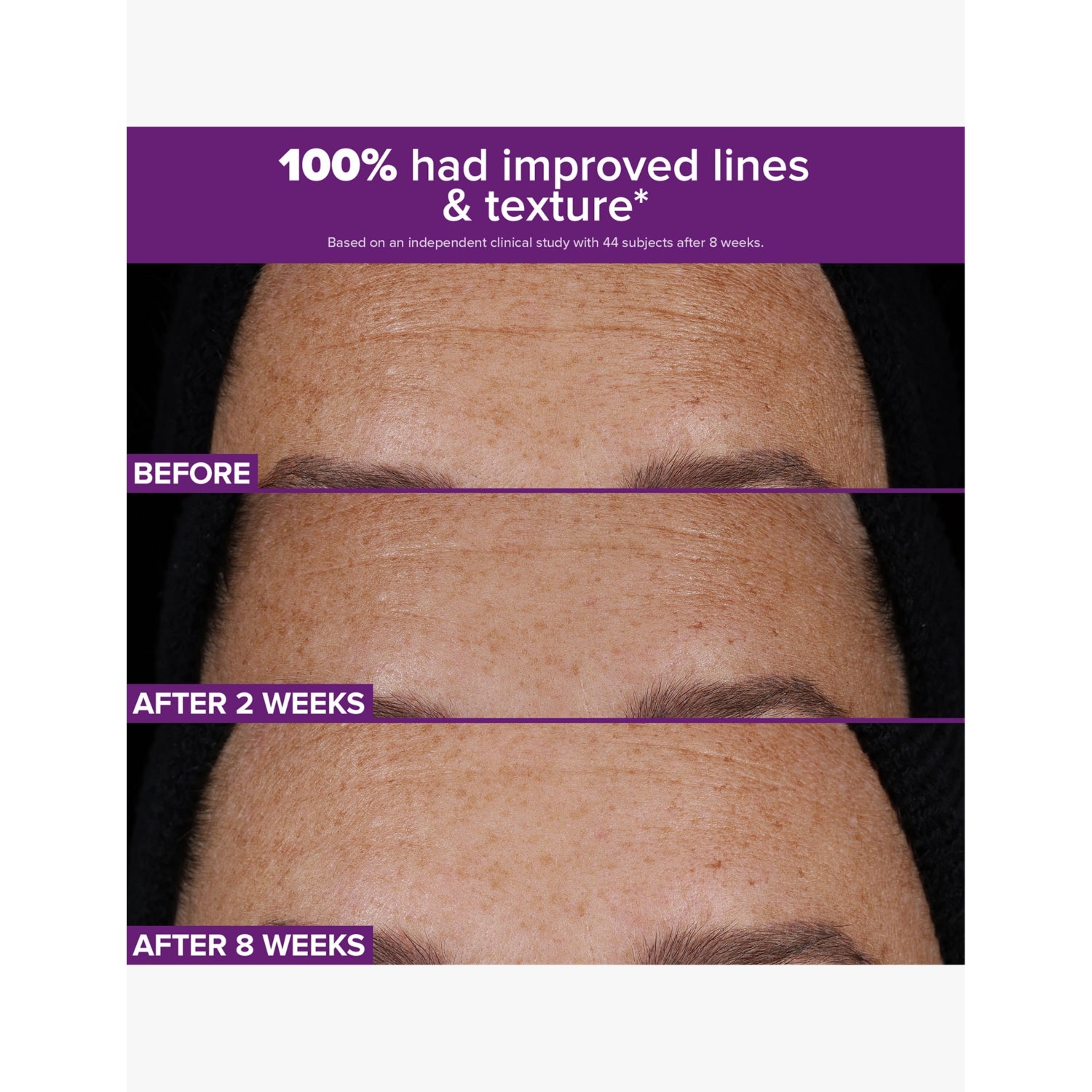 Paula's Choice Retinaldehyde Dual-Retinoid Treatment 30ml (British brand)
