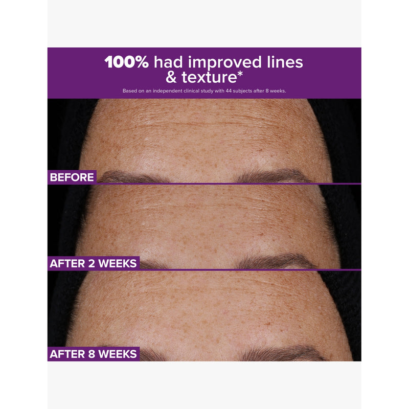 Paula's Choice Retinaldehyde Dual-Retinoid Treatment 30ml (British brand)