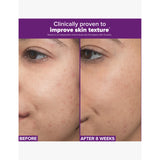 Paula's Choice Retinaldehyde Dual-Retinoid Treatment 30ml (British brand)