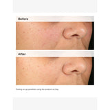 The Ordinary Alpha Arbutin 2% + HA serum 30ml (British brand)