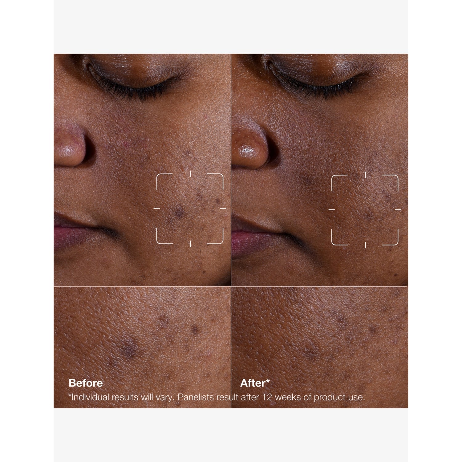 Clinique Even Better Clinical Dark Spot Clearing Serum 30ml (British brand)