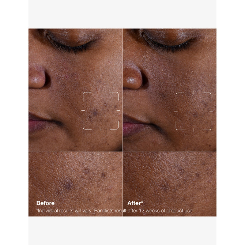 Clinique Even Better Clinical Dark Spot Clearing Serum 30ml (British brand)