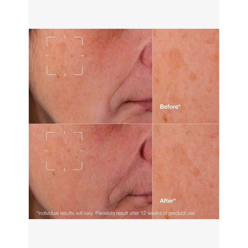 Clinique Even Better Clinical Dark Spot Clearing Serum 30ml (British brand)