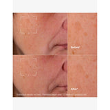 Clinique Even Better Clinical Dark Spot Clearing Serum 30ml (British brand)