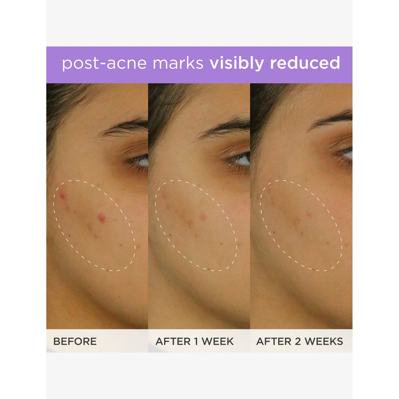 Tatcha brightening serum 30ml for face, imported from the UK